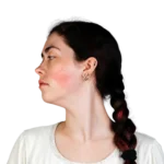 ALFA MEDICO D.o.o._Kapilare, Rdečic