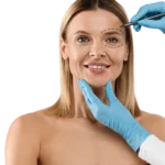 Alfa MEDICO Kirurški Poseg, Blefaroplastika_