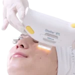 Alfa MEDICO_Fotopomlajevanje