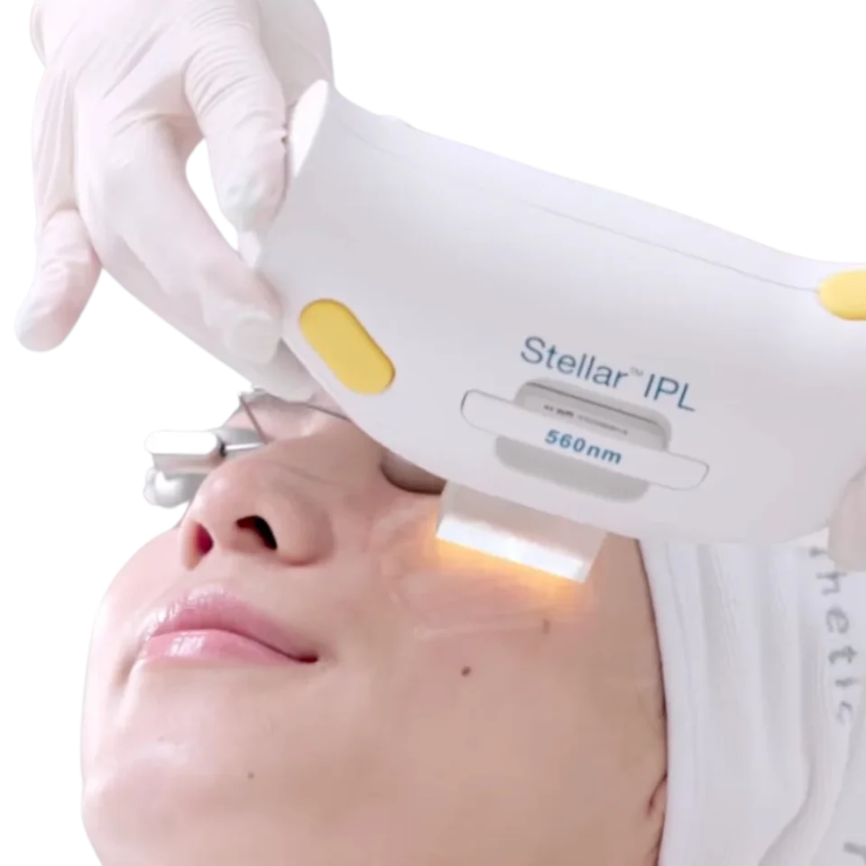 Alfa MEDICO_Fotopomlajevanje