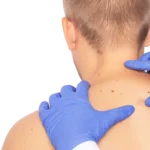 Alfa Medico D.o.o._Benigne Spremembe