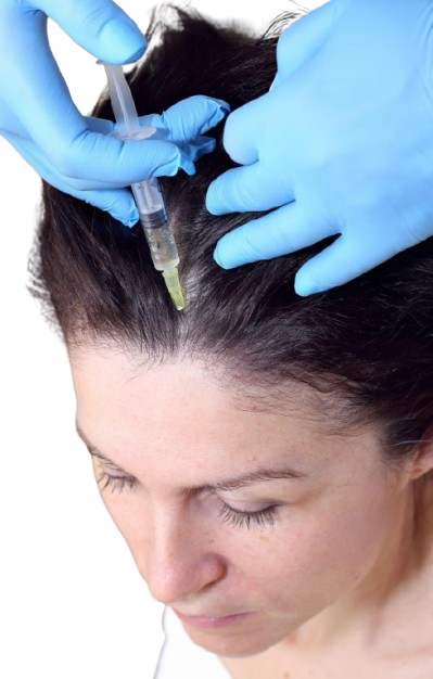 ExoSignal__Hair_Treatment_exosignal_hair_alfa_medico_jedlovčnik Removebg Preview