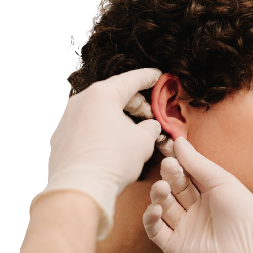 Otoplastika Korekcija štrlečih Ušes Alfa Medico