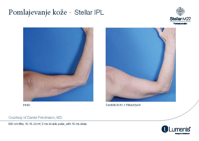 STELLAR BEFORE AFTER, PREVOD_Page_004
