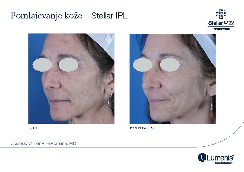 STELLAR BEFORE AFTER, PREVOD_Page_005