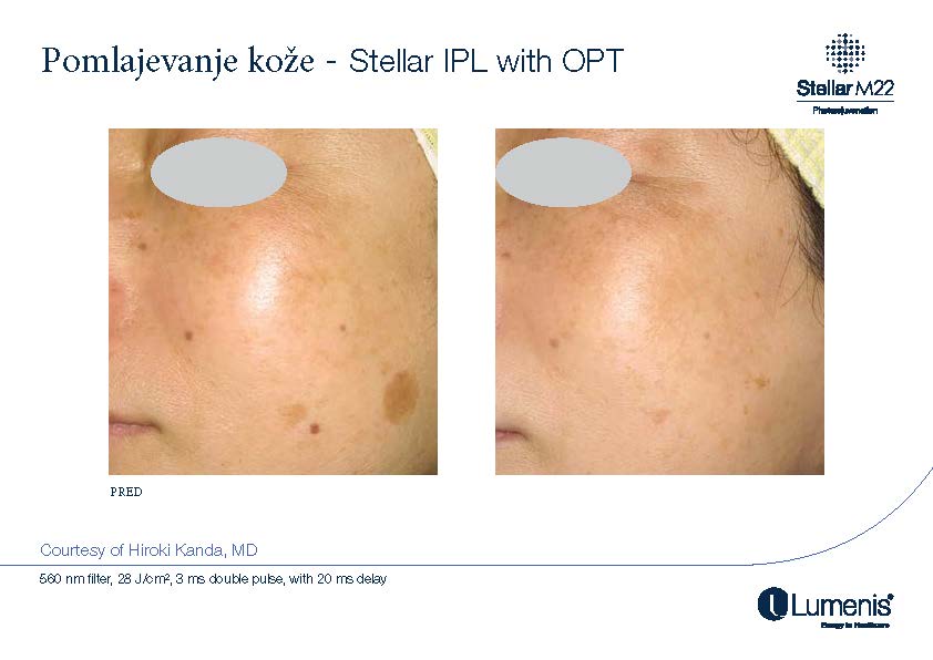 STELLAR BEFORE AFTER, PREVOD_Page_006
