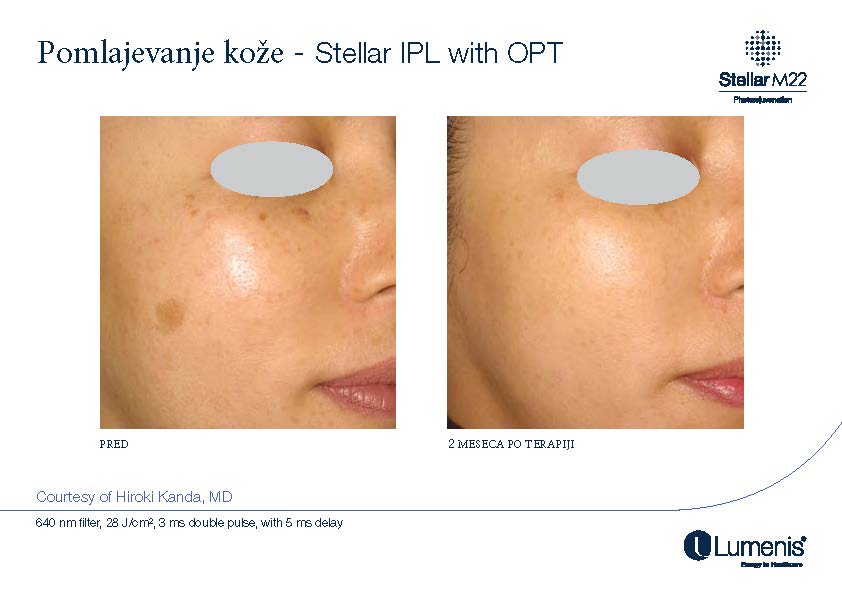 STELLAR BEFORE AFTER, PREVOD_Page_007