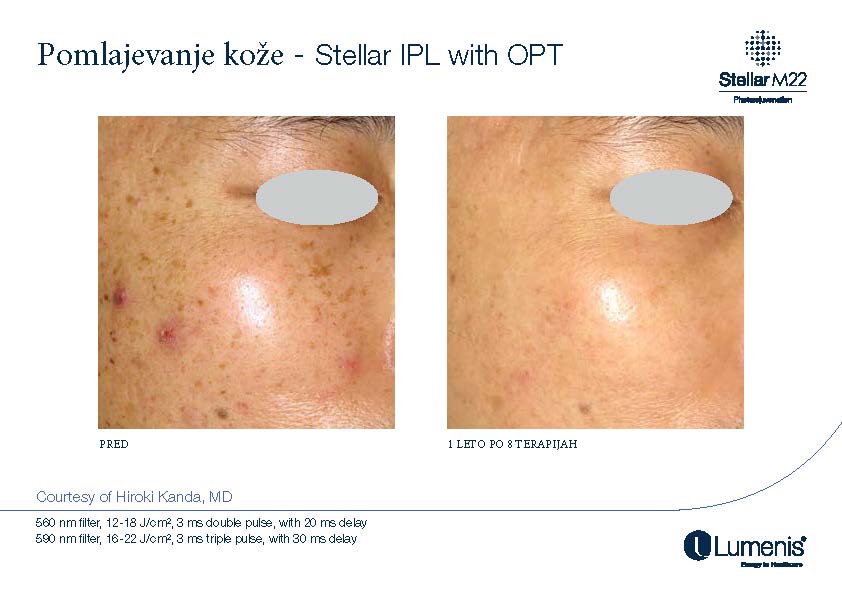STELLAR BEFORE AFTER, PREVOD_Page_009