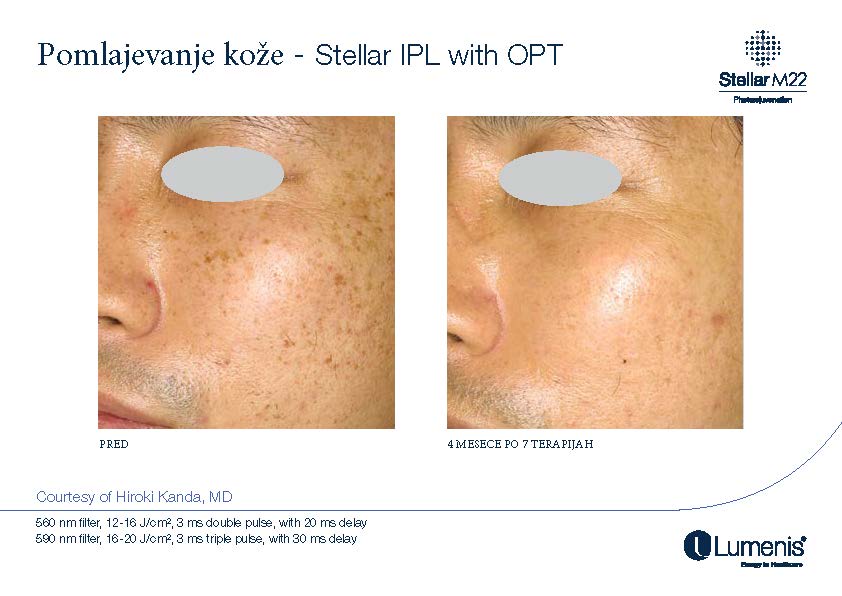 STELLAR BEFORE AFTER, PREVOD_Page_010