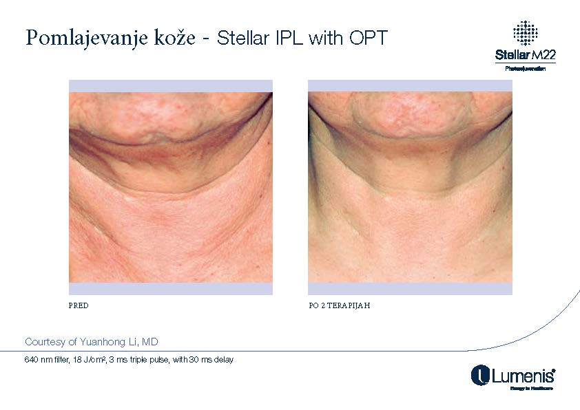 STELLAR BEFORE AFTER, PREVOD_Page_011