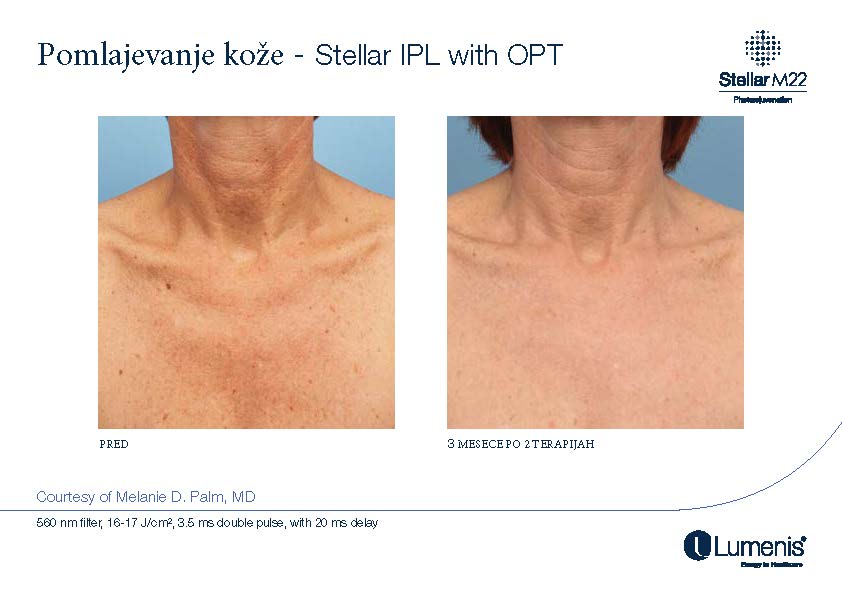 STELLAR BEFORE AFTER, PREVOD_Page_012
