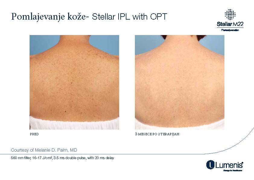 STELLAR BEFORE AFTER, PREVOD_Page_013
