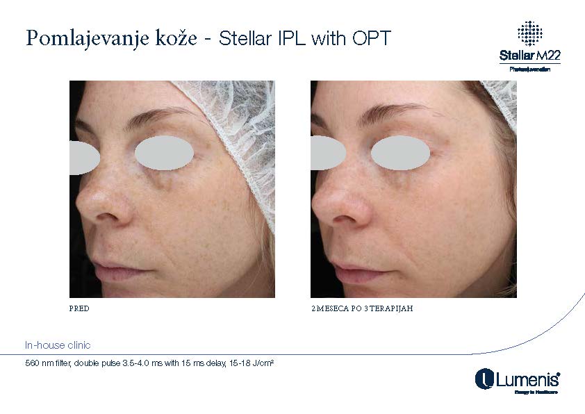 STELLAR BEFORE AFTER, PREVOD_Page_015