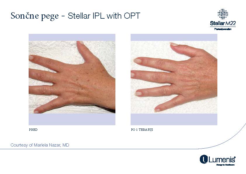 STELLAR BEFORE AFTER, PREVOD_Page_016