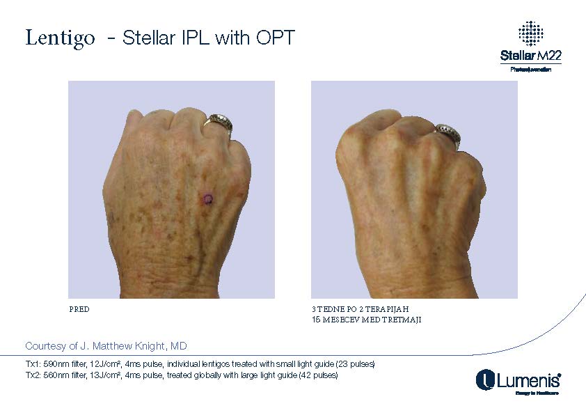STELLAR BEFORE AFTER, PREVOD_Page_019