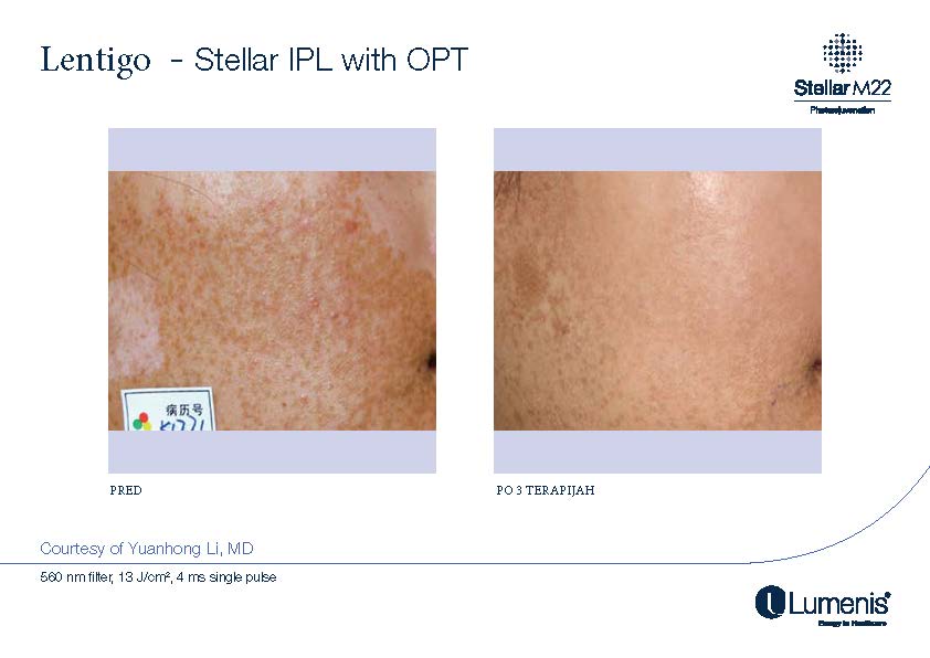 STELLAR BEFORE AFTER, PREVOD_Page_020