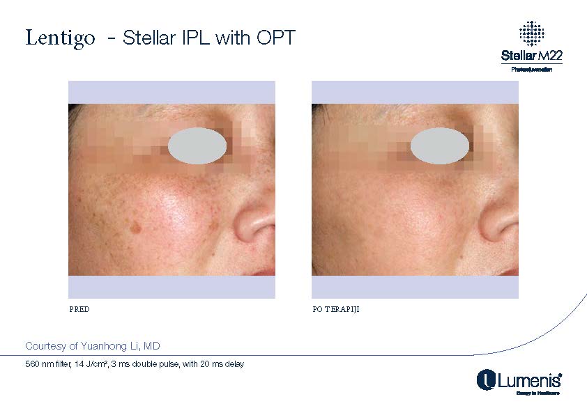 STELLAR BEFORE AFTER, PREVOD_Page_021