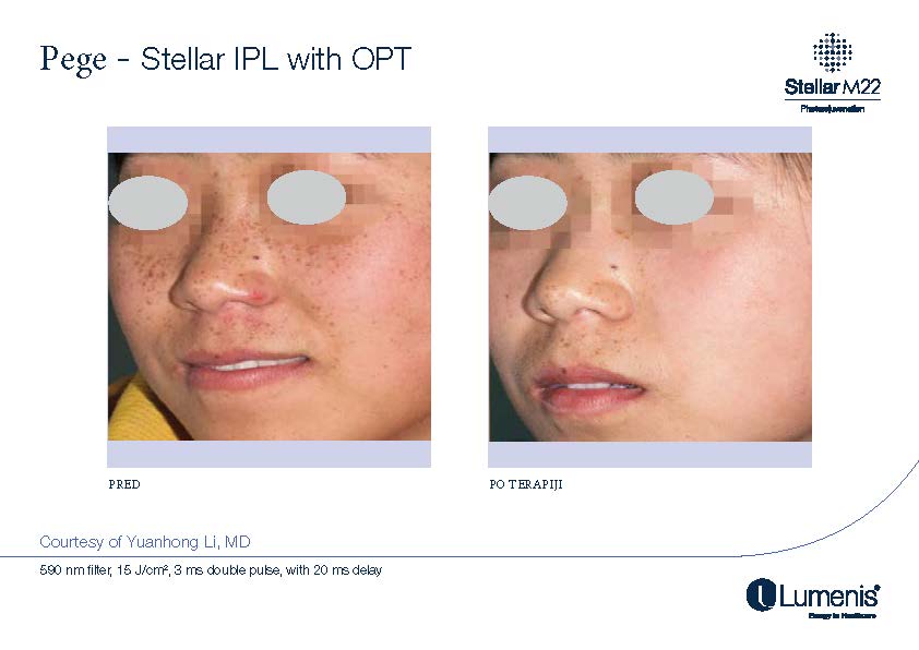 STELLAR BEFORE AFTER, PREVOD_Page_022
