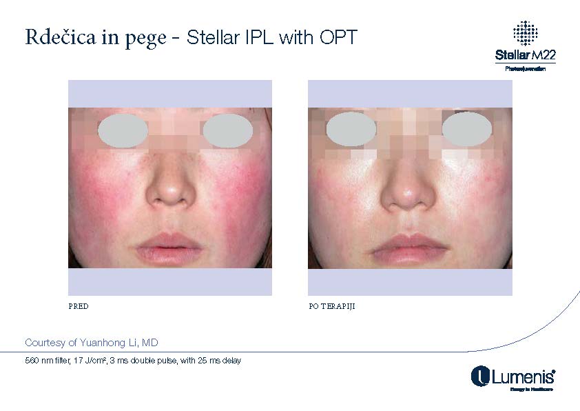 STELLAR BEFORE AFTER, PREVOD_Page_023